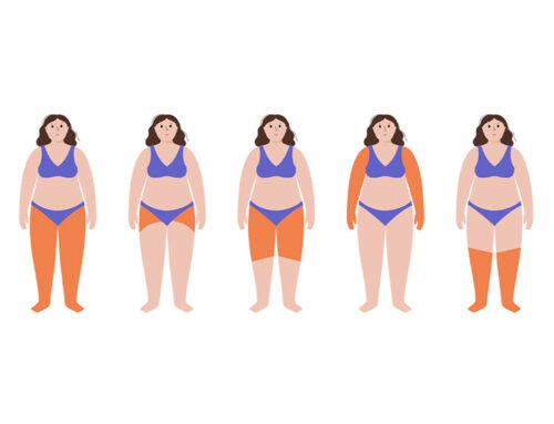 Lipedema e inflamação crônica